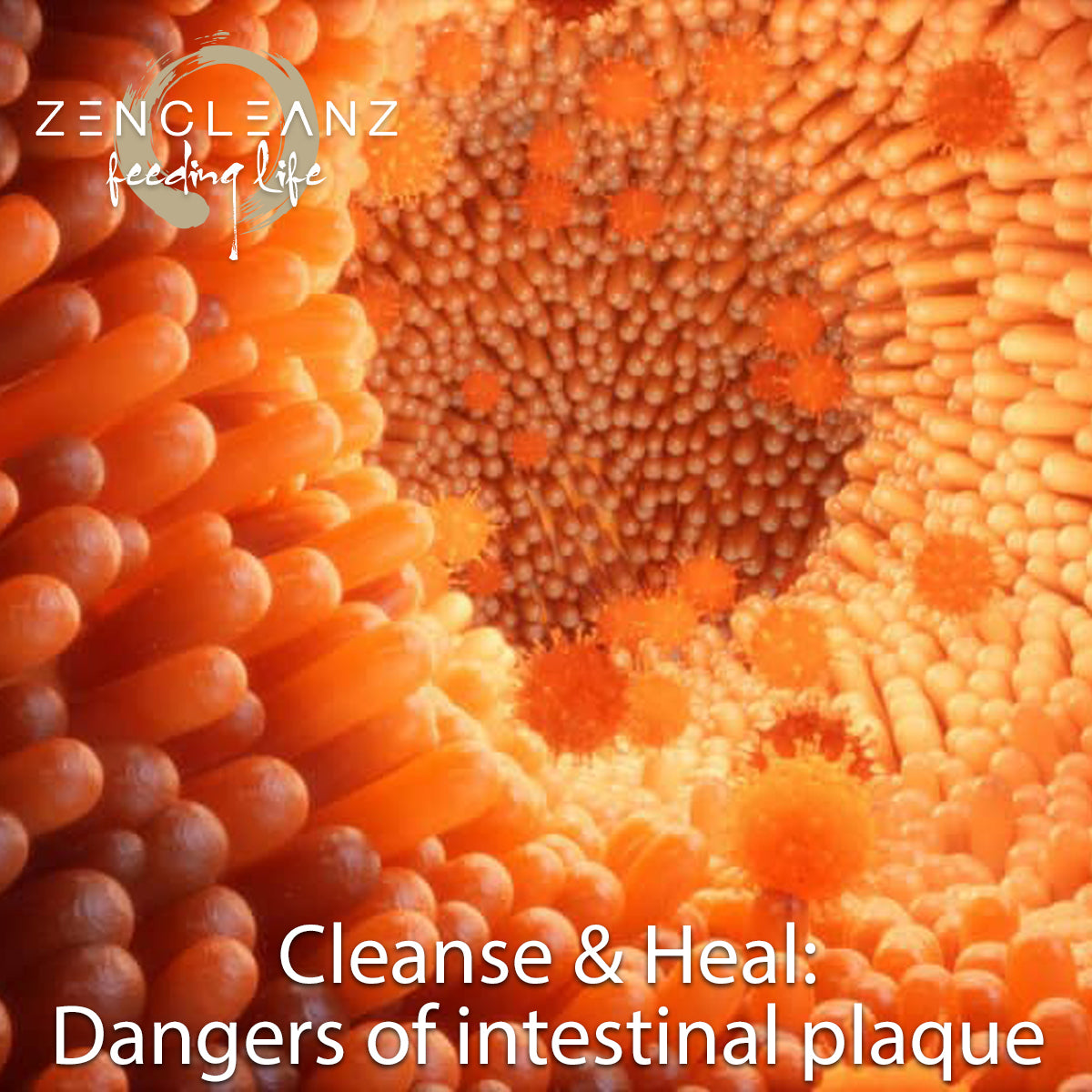 The dangers of intestinal plaque